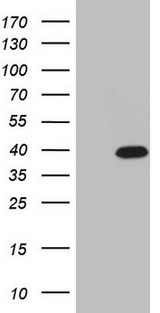 CABP4 Antibody - HEK293T cells were transfected with the pCMV6-ENTRY control. (Left lane) or pCMV6-ENTRY CABP4. (Right lane) cDNA for 48 hrs and lysed