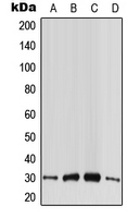 CABP4 Antibody - Western blot analysis of CABP4 expression in HeLa (A); HepG2 (B); SP2/0 (C); PC12 (D) whole cell lysates.