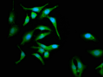 CABP4 Antibody - Immunofluorescence staining of Hela cells at a dilution of 1:133, counter-stained with DAPI. The cells were fixed in 4% formaldehyde, permeabilized using 0.2% Triton X-100 and blocked in 10% normal Goat Serum. The cells were then incubated with the antibody overnight at 4 °C.The secondary antibody was Alexa Fluor 488-congugated AffiniPure Goat Anti-Rabbit IgG (H+L) .