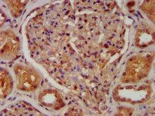 CABP4 Antibody - Immunohistochemistry image at a dilution of 1:400 and staining in paraffin-embedded human kidney tissue performed on a Leica BondTM system. After dewaxing and hydration, antigen retrieval was mediated by high pressure in a citrate buffer (pH 6.0) . Section was blocked with 10% normal goat serum 30min at RT. Then primary antibody (1% BSA) was incubated at 4 °C overnight. The primary is detected by a biotinylated secondary antibody and visualized using an HRP conjugated SP system.