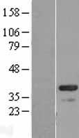 CABP4 Protein - Western validation with an anti-DDK antibody * L: Control HEK293 lysate R: Over-expression lysate