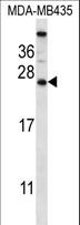 CABP5 Antibody - CABP5 Antibody western blot of MDA-MB435 cell line lysates (35 ug/lane). The CABP5 antibody detected the CABP5 protein (arrow).