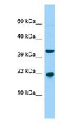 CABP5 Antibody - CABP5 antibody Western Blot of Fetal Liver.  This image was taken for the unconjugated form of this product. Other forms have not been tested.