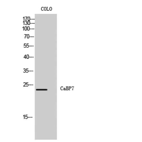CABP7 Antibody - Western blot of CaBP7 antibody