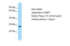 CABP7 Antibody -  This image was taken for the unconjugated form of this product. Other forms have not been tested.