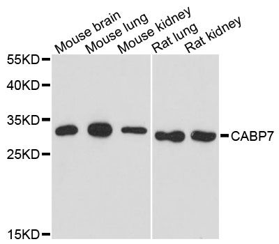 CABP7 Antibody - Western blot analysis of extracts of various cell lines, using CABP7 antibody at 1:3000 dilution. The secondary antibody used was an HRP Goat Anti-Rabbit IgG (H+L) at 1:10000 dilution. Lysates were loaded 25ug per lane and 3% nonfat dry milk in TBST was used for blocking. An ECL Kit was used for detection and the exposure time was 90s.