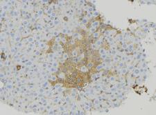 CABP7 Antibody - 1:100 staining mouse liver tissue by IHC-P. The sample was formaldehyde fixed and a heat mediated antigen retrieval step in citrate buffer was performed. The sample was then blocked and incubated with the antibody for 1.5 hours at 22°C. An HRP conjugated goat anti-rabbit antibody was used as the secondary.