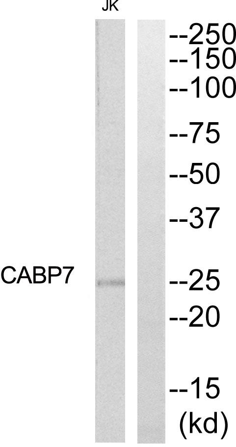 CABP7 Antibody - Western blot analysis of extracts from Jurkat cells, using CABP7 antibody.
