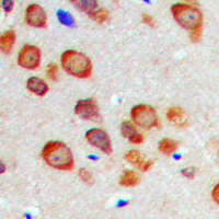 CABP7 Antibody - Immunohistochemical analysis of CABP7 staining in human brain formalin fixed paraffin embedded tissue section. The section was pre-treated using heat mediated antigen retrieval with sodium citrate buffer (pH 6.0). The section was then incubated with the antibody at room temperature and detected using an HRP-conjugated compact polymer system. DAB was used as the chromogen. The section was then counterstained with hematoxylin and mounted with DPX.