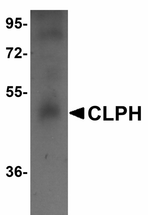 CABS1 Antibody - Western blot of CLPH in human testis tissue lysate with CLPH antibody at 1 ug/ml.