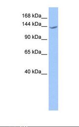 CACHD1 Antibody - Fetal brain lysate. Antibody concentration: 1.0 ug/ml. Gel concentration: 6-18%.  This image was taken for the unconjugated form of this product. Other forms have not been tested.