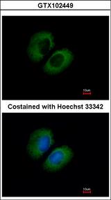 CACNA1B / Cav2.2 Antibody - Immunofluorescence of methanol-fixed A549 using CACNA1B antibody at 1:500 dilution.
