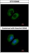 CACNA1B / Cav2.2 Antibody - Immunofluorescence of methanol-fixed A549 using CACNA1B antibody at 1:500 dilution.