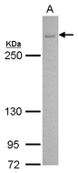 CACNA1B / Cav2.2 Antibody - CACNA1B antibody [C3], C-term detects CACNA1B protein by Western blot analysis. A. 30 ug U87-MG whole cell lysate/extract. 5 % SDS-PAGE. CACNA1B antibody [C3], C-term dilution:1:500