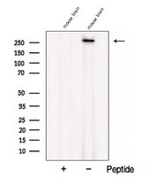 CACNA1B / Cav2.2 Antibody - Western blot analysis of extracts of mouse brain tissue using CACNA1B antibody. The lane on the left was treated with blocking peptide.