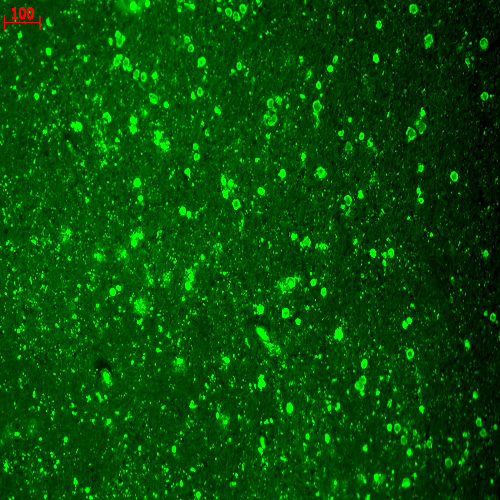 CACNA1C / Cav1.2 Antibody - Cav1.2 (S57-46), Human hippocampus.  This image was taken for the unconjugated form of this product. Other forms have not been tested.