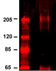 CACNA1C / Cav1.2 Antibody - Cav1 2 (S57-46), From INS-1E cells stained with anti-Cav1.2 poly.  This image was taken for the unconjugated form of this product. Other forms have not been tested.