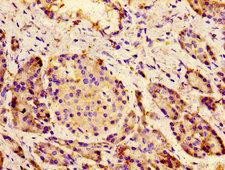 CACNA1C / Cav1.2 Antibody - Immunohistochemistry image of paraffin-embedded human pancreatic tissue at a dilution of 1:100