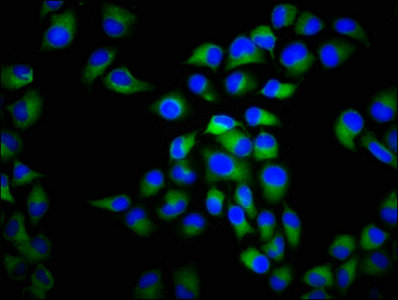 CACNA1C / Cav1.2 Antibody - Immunofluorescence staining of Hela cells with CACNA1C Antibody at 1:266, counter-stained with DAPI. The cells were fixed in 4% formaldehyde, permeabilized using 0.2% Triton X-100 and blocked in 10% normal Goat Serum. The cells were then incubated with the antibody overnight at 4°C. The secondary antibody was Alexa Fluor 488-congugated AffiniPure Goat Anti-Rabbit IgG(H+L).
