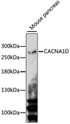 CACNA1D / Cav1.3 Antibody - Western blot analysis of extracts of Mouse pancreas, using CACNA1D antibody at 1:3000 dilution. The secondary antibody used was an HRP Goat Anti-Rabbit IgG (H+L) at 1:10000 dilution. Lysates were loaded 25ug per lane and 3% nonfat dry milk in TBST was used for blocking. An ECL Kit was used for detection and the exposure time was 5min.