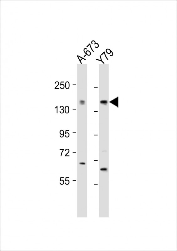 CACNA1F / Cav1.4 Antibody - All lanes: Anti-CACNA1F Antibody (Center) at 1:2000 dilution. Lane 1: A-673 whole cell lysate. Lane 2: Y79 whole cell lysate Lysates/proteins at 20 ug per lane. Secondary Goat Anti-Rabbit IgG, (H+L), Peroxidase conjugated at 1:10000 dilution. Predicted band size: 221 kDa. Blocking/Dilution buffer: 5% NFDM/TBST.