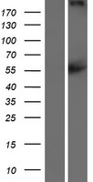 CACNA1F / Cav1.4 Protein - Western validation with an anti-DDK antibody * L: Control HEK293 lysate R: Over-expression lysate