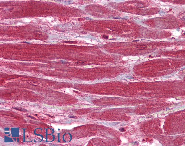 CACNA1G / Cav3.1 Antibody - Human Heart: Formalin-Fixed, Paraffin-Embedded (FFPE).  This image was taken for the unconjugated form of this product. Other forms have not been tested.