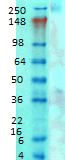 CACNA1G / Cav3.1 Antibody - Western blot analysis of Cav3.1 in rat brain membrane tissues, using a 1:1000 dilution of CACNA1G / Cav3.1 antibody.  This image was taken for the unconjugated form of this product. Other forms have not been tested.