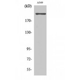 CACNA1H / Cav3.2 Antibody - Western blot of T-type Ca++ CP alpha1H antibody