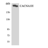 CACNA1H / Cav3.2 Antibody - Western blot analysis of the lysates from HeLa cells using CACNA1H antibody.