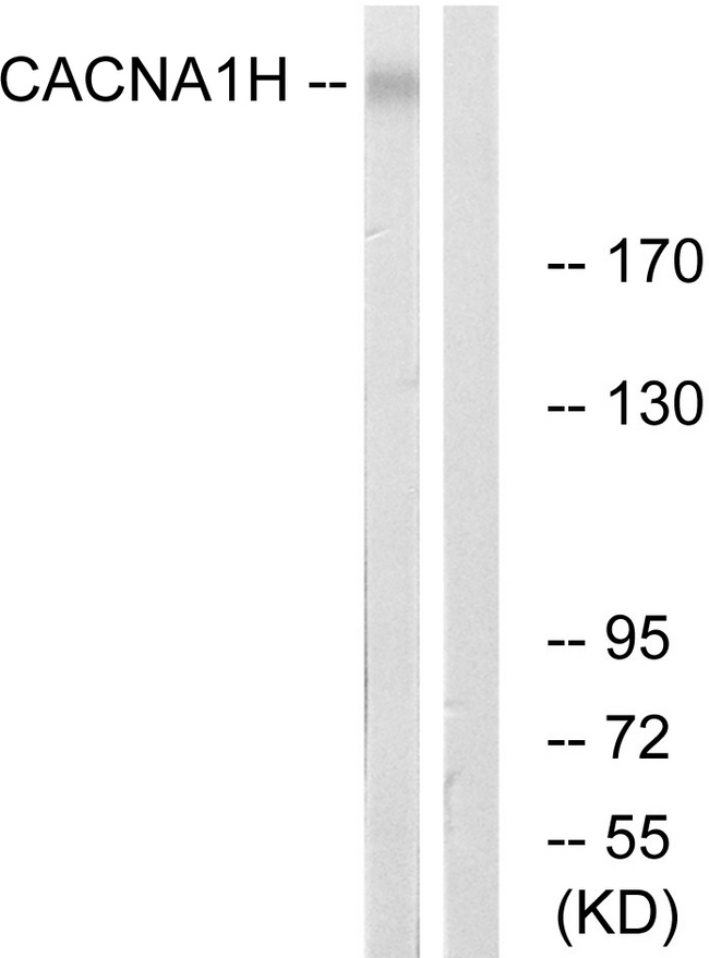 CACNA1H / Cav3.2 Antibody - Western blot analysis of lysates from A549 cells, using CACNA1H Antibody. The lane on the right is blocked with the synthesized peptide.