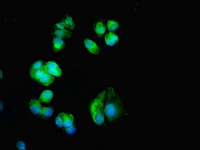 CACNA1H / Cav3.2 Antibody - Immunofluorescent analysis of MCF-7 cells diluted at 1:100 and Alexa Fluor 488-congugated AffiniPure Goat Anti-Rabbit IgG(H+L)