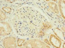 CACNA1H / Cav3.2 Antibody - Immunohistochemistry of paraffin-embedded human kidney tissue at dilution 1:100