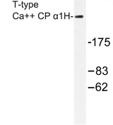 CACNA1H / Cav3.2 Antibody - Western blot of T-type Ca++ CP 1H (P492) pAb in extracts from A549 cells.
