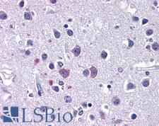 CACNA1I / Cav3.3 Antibody - Anti-CACNA1I / Cav3.3 antibody IHC of human brain, cortex. Immunohistochemistry of formalin-fixed, paraffin-embedded tissue after heat-induced antigen retrieval. Antibody concentration 5 ug/ml.  This image was taken for the unconjugated form of this product. Other forms have not been tested.