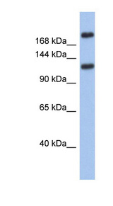 CACNA1I / Cav3.3 Antibody - CACNA1I / Cav3.3 antibody Western blot of Fetal Small Intestine lysate. This image was taken for the unconjugated form of this product. Other forms have not been tested.