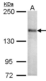 CACNA1S / Cav1.1 Antibody - Sample (30 ug of whole cell lysate). A:293T. 5% SDS PAGE. CACNA1S antibody diluted at 1:1000.