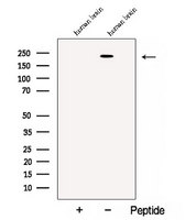 CACNA1S / Cav1.1 Antibody - Western blot analysis of extracts of human brain tissue using CACNA1S antibody. The lane on the left was treated with blocking peptide.