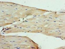 CACNA2D1 Antibody - Immunohistochemistry of paraffin-embedded human skeletal muscle tissue using antibody at 1:100 dilution.  This image was taken for the unconjugated form of this product. Other forms have not been tested.