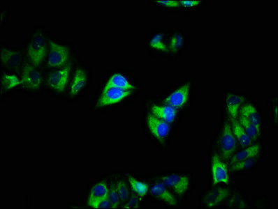 CACNA2D1 Antibody - Immunofluorescence staining of Hela cells with CACNA2D1 Antibody at 1:200, counter-stained with DAPI. The cells were fixed in 4% formaldehyde, permeabilized using 0.2% Triton X-100 and blocked in 10% normal Goat Serum. The cells were then incubated with the antibody overnight at 4°C. The secondary antibody was Alexa Fluor 488-congugated AffiniPure Goat Anti-Rabbit IgG(H+L).