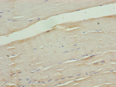 CACNA2D1 Antibody - Immunohistochemistry of paraffin-embedded human skeletal muscle tissue using CACNA2D1 Antibody at dilution of 1:100