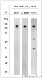 CACNA2D1 Antibody - Rabbit antibody to CACNA2D1 (600-650). WB on mouse tissue lysates. Blocking: 1% LFDM for 30 min at RT; primary antibody: dilution 1:2000 incubated at 4C overnight.