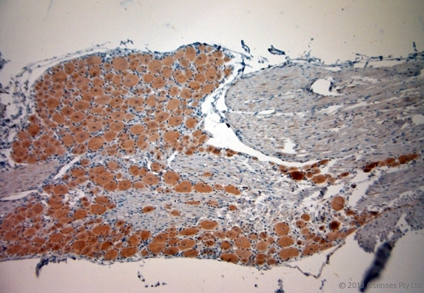 CACNA2D1 Antibody - Rabbit antibody to CACNA2D1 (600-650). IHC-P on paraffin sections of rat DRG. The animal was perfused using Autoperfuser at a pressure of 110 mm Hg with 300 ml 4% FA and further post fixed overnight before being processed for paraffin embedding. HIER: Tris-EDTA, pH 9 for 20 min using Thermo PT Module. Blocking: 0.2% LFDM in TBST filtered through a 0.2 micron filter. Detection was done using Novolink HRP polymer from Leica following manufacturers instructions. Primary antibody: dilution 1:1000, incubated 30 min at RT using Autostainer. Sections were counterstained with Harris Hematoxylin.