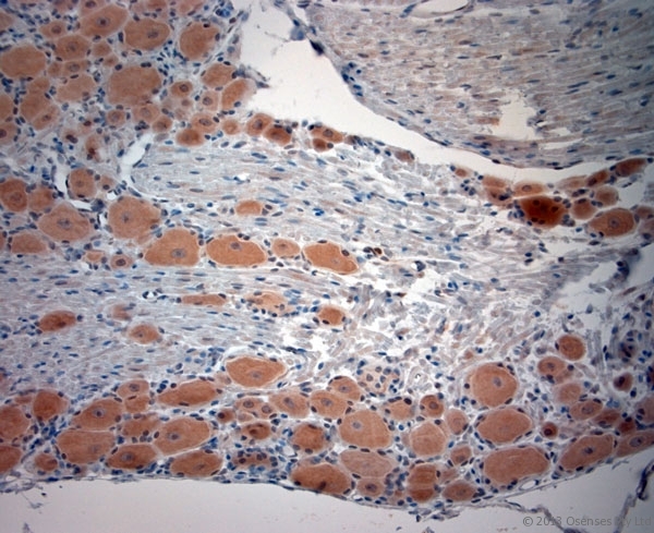 CACNA2D1 Antibody - Rabbit antibody to CACNA2D1 (600-650). IHC-P on paraffin sections of rat DRG. The animal was perfused using Autoperfuser at a pressure of 110 mm Hg with 300 ml 4% FA and further post fixed overnight before being processed for paraffin embedding. HIER: Tris-EDTA, pH 9 for 20 min using Thermo PT Module. Blocking: 0.2% LFDM in TBST filtered through a 0.2 micron filter. Detection was done using Novolink HRP polymer from Leica following manufacturers instructions. Primary antibody: dilution 1:1000, incubated 30 min at RT using Autostainer. Sections were counterstained with Harris Hematoxylin.