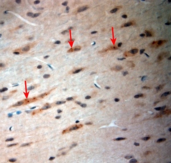 CACNA2D1 Antibody - Rabbit antibody to CACNA2D1 (600-650). IHC-P on paraffin sections of rat brain. The animal was perfused using Autoperfuser at a pressure of 110 mm Hg with 300 ml 4% FA and further post fixed overnight before being processed for paraffin embedding. HIER: Tris-EDTA, pH 9 for 20 min using Thermo PT Module. Blocking: 0.2% LFDM in TBST filtered through a 0.2 micron filter. Detection was done using Novolink HRP polymer from Leica following manufacturers instructions. Primary antibody: dilution 1:1000, incubated 30 min at RT using Autostainer. Sections were counterstained with Harris Hematoxylin.