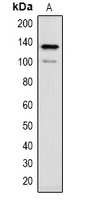 CACNA2D1 Antibody - Western blot analysis of CACNA2D1 expression in rat brain (A) whole cell lysates.