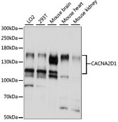 CACNA2D1 Antibody - Western blot analysis of extracts of various cell lines, using CACNA2D1 antibody at 1:1000 dilution. The secondary antibody used was an HRP Goat Anti-Rabbit IgG (H+L) at 1:10000 dilution. Lysates were loaded 25ug per lane and 3% nonfat dry milk in TBST was used for blocking. An ECL Kit was used for detection and the exposure time was 5S.