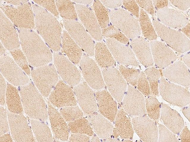 CACNA2D1 Antibody - Immunochemical staining of human CACNA2D1 in human skeletal muscle with rabbit polyclonal antibody at 1:100 dilution, formalin-fixed paraffin embedded sections.
