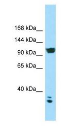 CACNA2D2 Antibody - CACNA2D2 antibody Western Blot of HCT15.  This image was taken for the unconjugated form of this product. Other forms have not been tested.