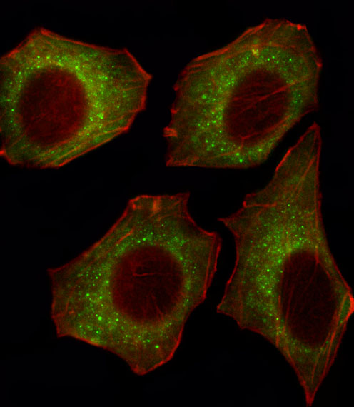 CACNA2D2 Antibody - Fluorescent image of U251 cell stained with CACNA2D2 Antibody. U251 cells were fixed with 4% PFA (20 min), permeabilized with Triton X-100 (0.1%, 10 min), then incubated with CACNA2D2 primary antibody (1:25, 1 h at 37°C). For secondary antibody, Alexa Fluor 488 conjugated donkey anti-rabbit antibody (green) was used (1:400, 50 min at 37°C). Cytoplasmic actin was counterstained with Alexa Fluor 555 (red) conjugated Phalloidin (7units/ml, 1 h at 37°C). CACNA2D2 immunoreactivity is localized to Cytoplasm significantly.